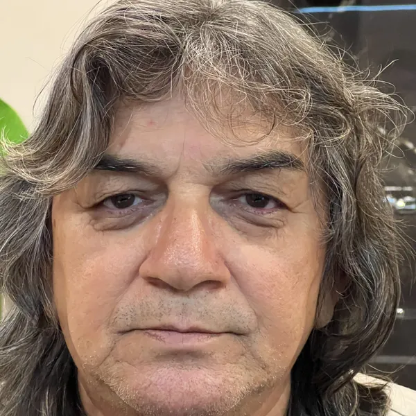 Avaliação dermatofuncional periorbital prévia Condição Pré-procedimento com linhas finas perioculares - Antes